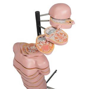 MRI Torso Model, 15 schijven