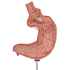 Maagband Model
