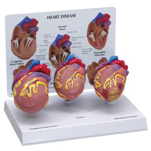 3 mini hart set + infokaart