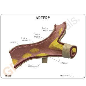 Arteriemodel met infokaart