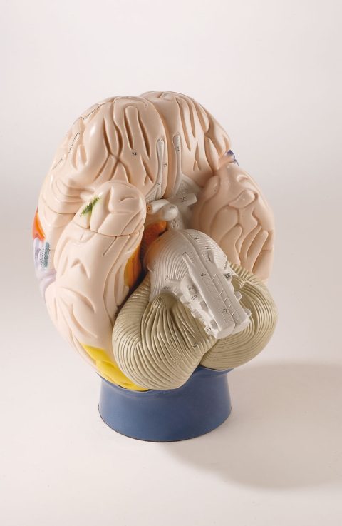 Functionele Hersenzones Model