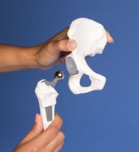 Heupimplantaat Model
