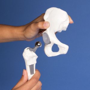 Heupimplantaat Model