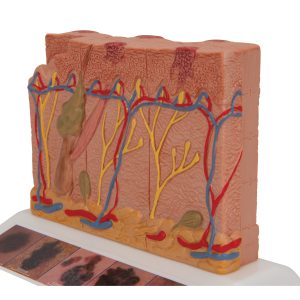 Huidkanker model