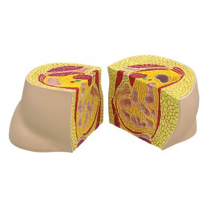 Obesitas model