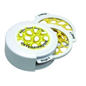 Osteoporose Schijven Set (4 stadia)