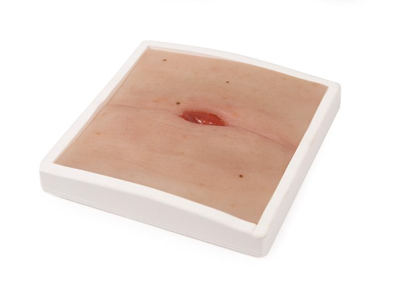Colostoma in Buikplooi Model