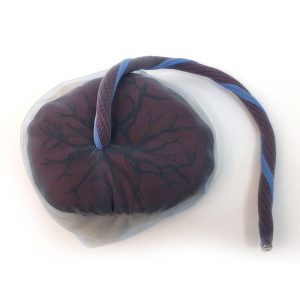 Placenta en navelstreng