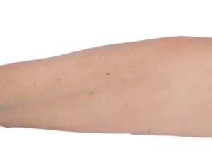 Geavanceerde Injectie Trainingsarm Puncture Pete