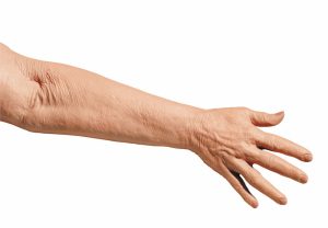 Geriatrische Oefenarm IV Injectie