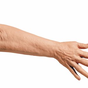 Geriatrische Oefenarm IV Injectie