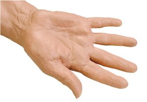 Geriatrische Oefenarm IV Injectie
