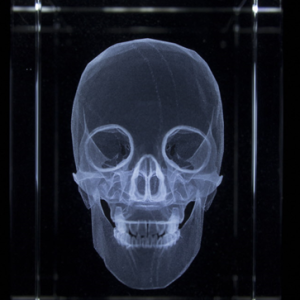 Anatomie Glasblok Schedel