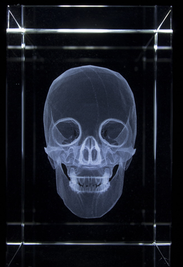 Anatomie Glasblok Schedel