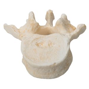 set van 5 losse Lumbale wervels, BONElike