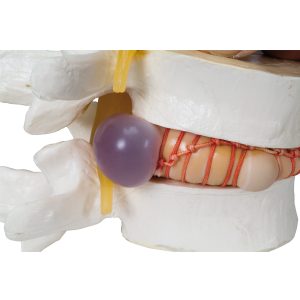 Hernia Simulator