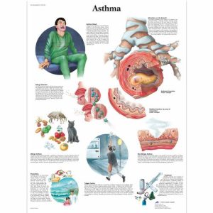 Astma Poster Gelamineerd
