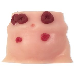 Stoma verzorging oefenmodel
