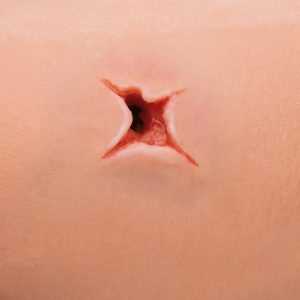 Wond en Bloeding Trainingsarm