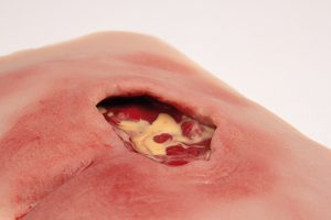 Decubitus Wond Model, Gereinigd