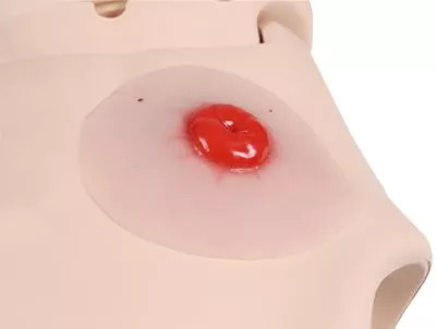 Colostomie Wondmodel, Zelfklevend