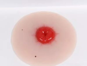 Colostomie Wondmodel, Zelfklevend