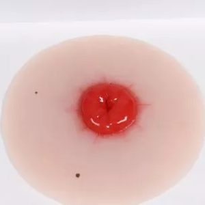 Colostomie Wondmodel, Zelfklevend