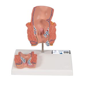 Aambei model