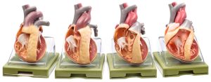 Aangeboren Hartziektes Modellen Set