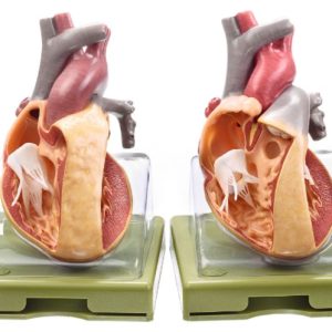 Aangeboren Hartziektes Modellen Set