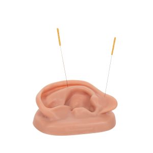 2 Acupunctuur oren