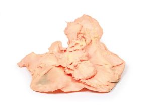 Adenomacarcinoom in de Maag, 3D Print