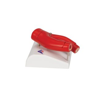 Aderverkalking Model