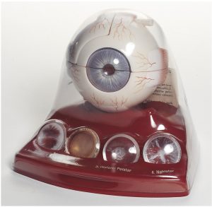 Anatomisch Model Cataract (Staar)