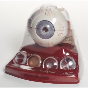 Anatomisch Model Cataract (Staar)