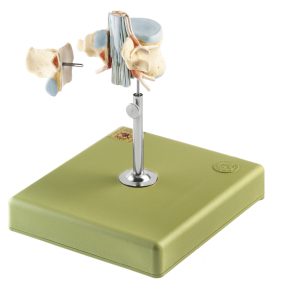 Anatomisch Model Lendenwervel (L II) met Ruggenmerg