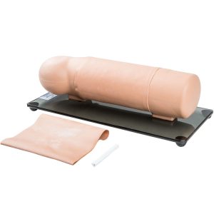 Anticonceptie Implantaat Arm