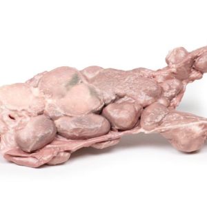 Aorta & Para-aortale Lymfeklieren, 3D Print