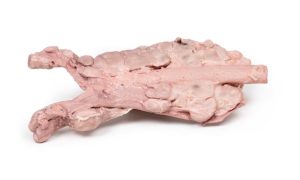 Aorta & Para-aortale Lymfeklieren, 3D Print