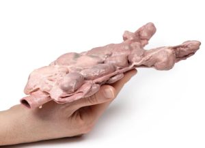 Aorta & Para-aortale Lymfeklieren, 3D Print