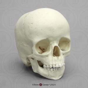 Archaische Schedel Kind, 5 jaar