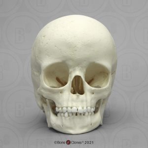 Archaische Schedel Kind, 5 jaar