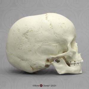 Archaische Schedel Kind, 5 jaar
