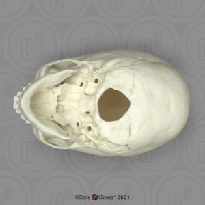 Archaische Schedel Kind, 5 jaar