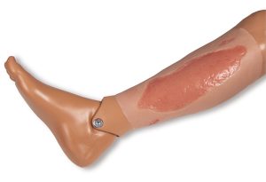 Arteriële Beenzweer Wond, Epithelisatiefase