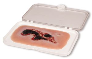 Arteriële Beenzweer Wond, Exsudatiefase