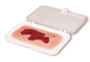 Arteriële Beenzweer Wond, Granulatiefase