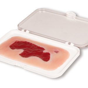 Arteriële Beenzweer Wond, Granulatiefase