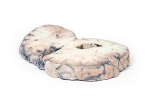 Arterioveneuze Malformatie in de Hersenen, 3D Print