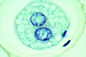 Ascaris megalocephala Embryologie Preparatenset